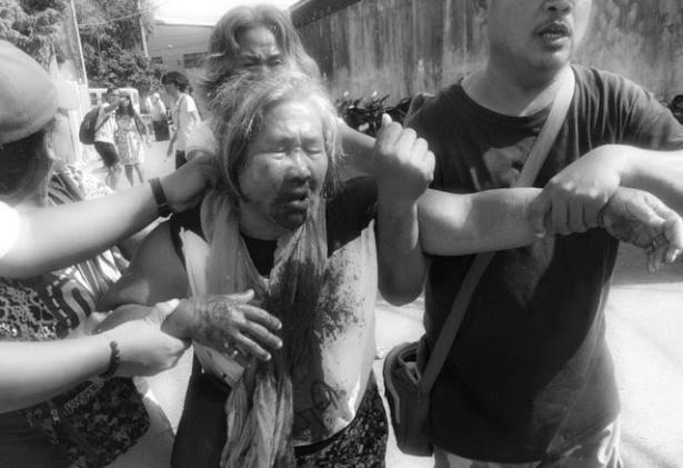 beaten and injured activist from Filipino demonstration