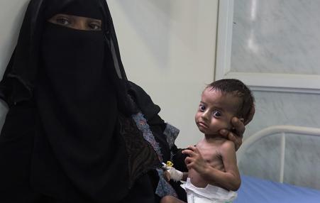 Nora brings her four month-old son Saleh to Al Hudaydah’s main hospital. 
